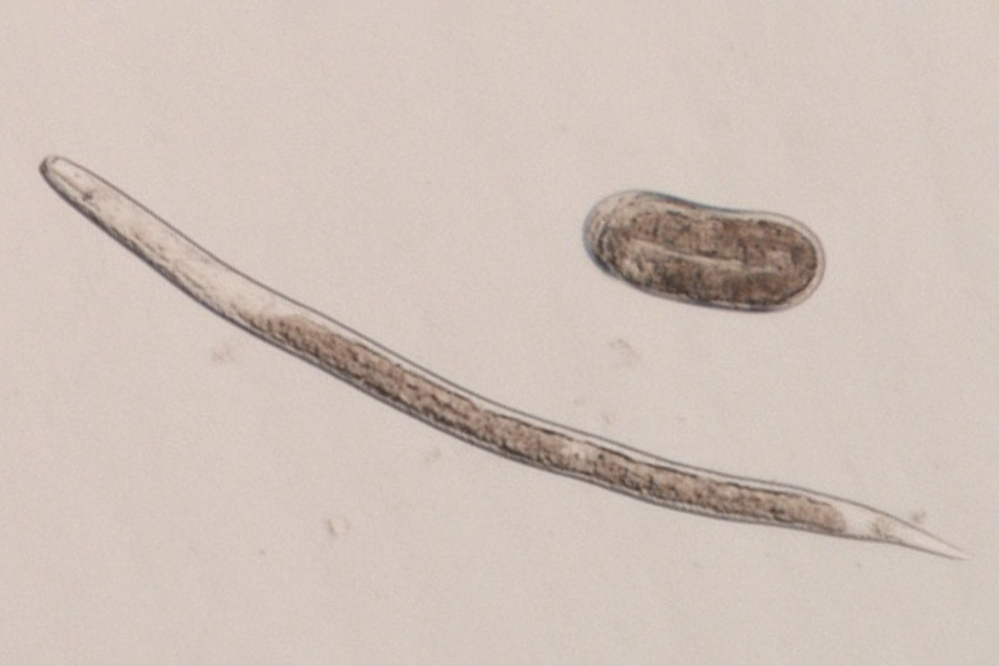 Image of an SCN egg and a juvenile (J2) nematode, which is the stage that infects soybean.