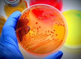 E-coli in petrie dish