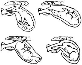 Abnormal positions of the calf for delivery