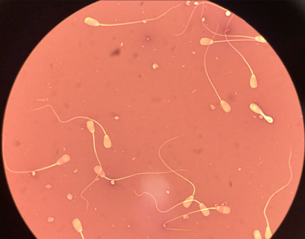 Bull sperm viewed under a microscope.