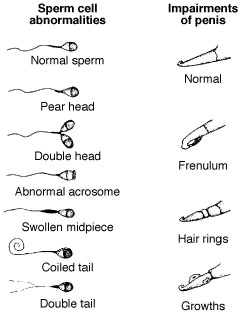 Drawings of various sperm cell abornomalities and penis impairments.