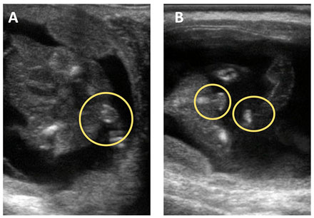 Ultrasound views showing a heifer calf and a bull calf at 75 days of gestation.