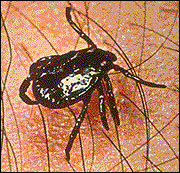 small tick on human skin with hair