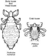 Types of lice that infest human beings