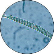 Multicelled, needle-like ascospores of Ophiosphaerella agrostis
