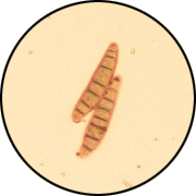 Sporulation of Drechslera erythrospila