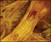 Bulbils of Rhizoctonia zeae in leaf tissue