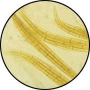 Darkly pigmented, multicelled ascospores within asci