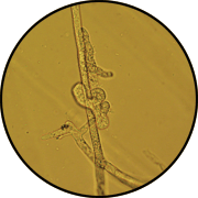 A lobate sporangium 
