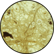 Discoloration of vascular cylinder of roots