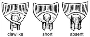 Auricle types