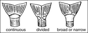 Collar types