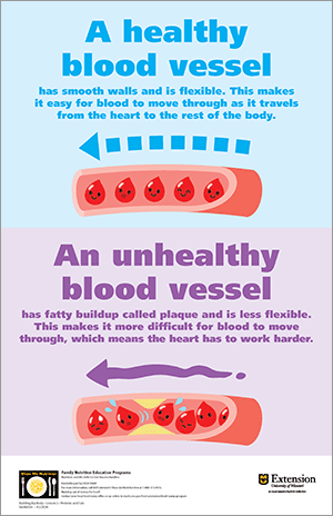 Blood vessels poster