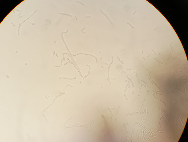 The microscope image of oak wilt fungus.