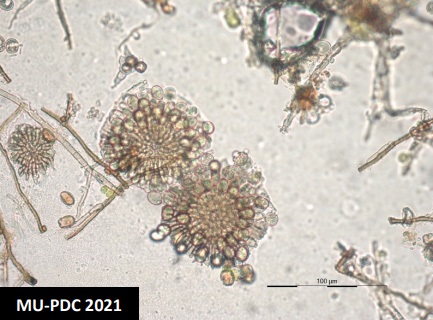 Microscope view