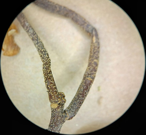 A fruiting body under a microscope.