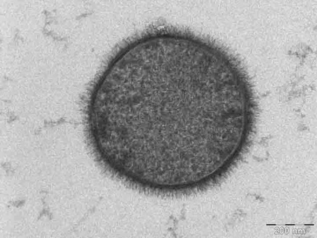 Common soil bacterium: Bacillus subtilis.Public domain image