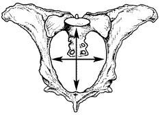 Prebreeding Exams for Beef Replacement Heifers